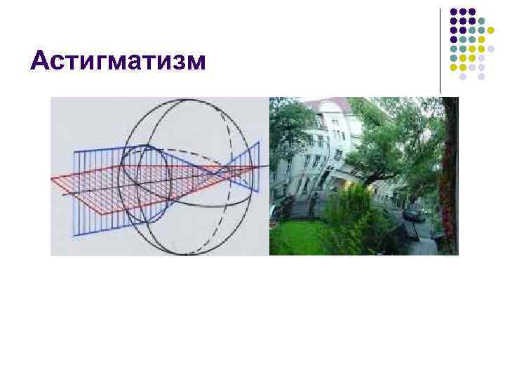 Астигматизм 