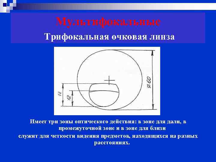 Мультифокальные Трифокальная очковая линза Имеет три зоны оптического действия: в зоне для дали, в