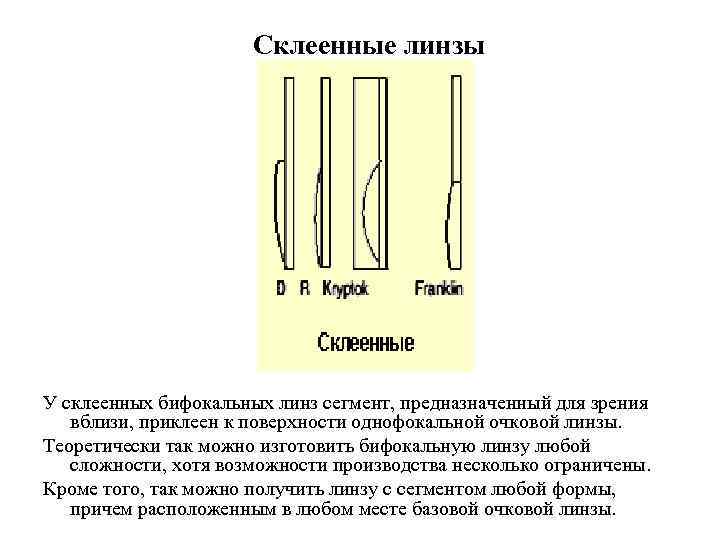 Склеенные линзы У склеенных бифокальных линз сегмент, предназначенный для зрения вблизи, приклеен к поверхности