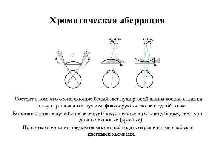 Хроматическая аберрация Состоит в том, что составляющие белый свет лучи разной длины волны, падая