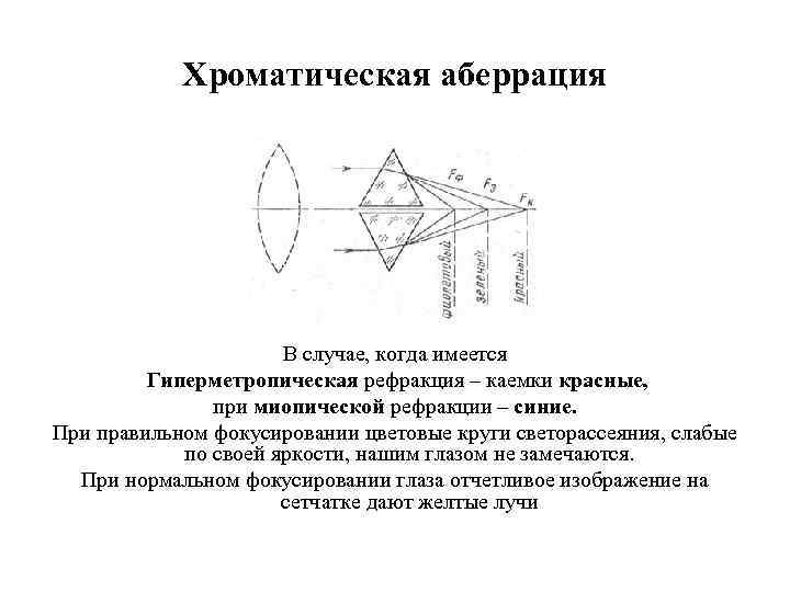 Убрать хроматическую аберрацию. Хроматическая аберрация. Хроматическая аберрация глаза. Хроматические аберрации объектива. Аберрация оптической системы.