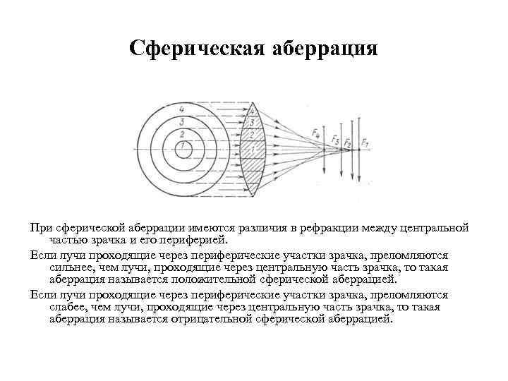 Сферическая аберрация При сферической аберрации имеются различия в рефракции между центральной частью зрачка и