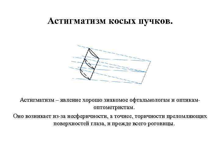 Астигматизм косых пучков. Астигматизм – явление хорошо знакомое офтальмологам и оптикамоптометристам. Оно возникает из-за