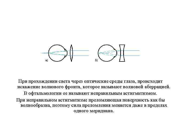 Схема прохождения света через глаз