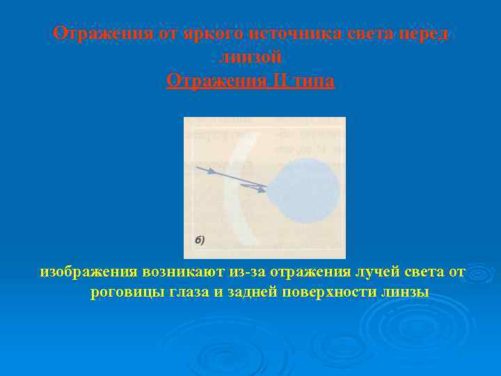 Отражения от яркого источника света перед линзой Отражения II типа изображения возникают из-за отражения