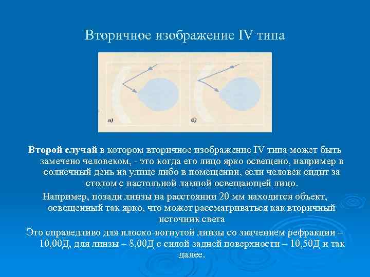 Вторичное изображение IV типа Второй случай в котором вторичное изображение IV типа может быть