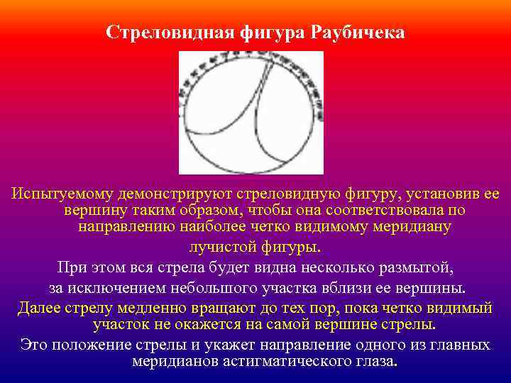 Стреловидная фигура Раубичека Испытуемому демонстрируют стреловидную фигуру, установив ее вершину таким образом, чтобы она