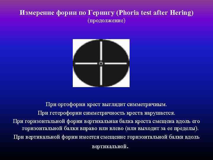 Измерение фории по Герингу (Phoria test after Hering) (продолжение) При ортофории крест выглядит симметричным.