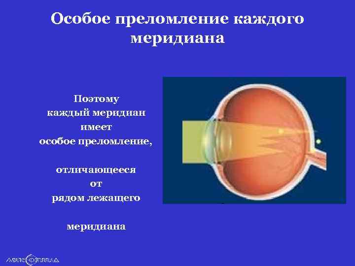 Особое преломление каждого меридиана Поэтому каждый меридиан имеет особое преломление, отличающееся от рядом лежащего