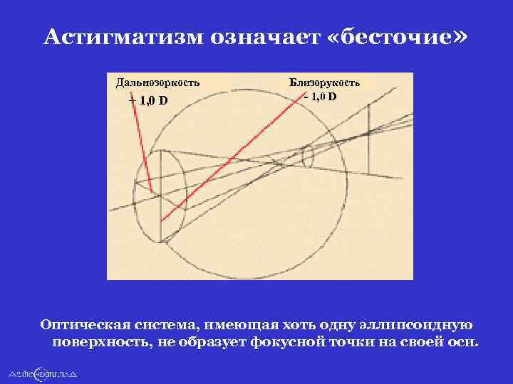 Астигматизм означает «бесточие» Дальнозоркость + 1, 0 D Близорукость - 1, 0 D Оптическая