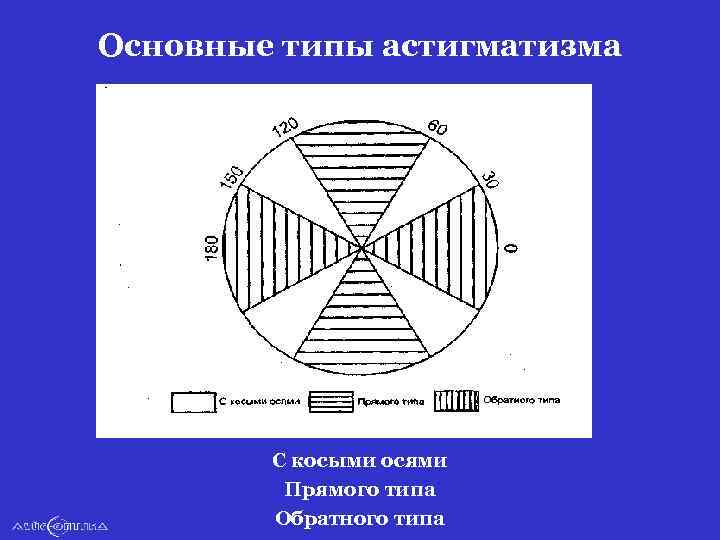 Основные типы астигматизма С косыми осями Прямого типа Обратного типа 