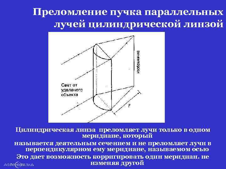 Преломление пучка параллельных лучей цилиндрической линзой Цилиндрическая линза преломляет лучи только в одном меридиане,