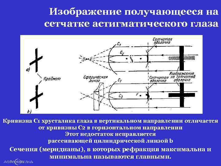 Изображение получающееся на сетчатке астигматического глаза Кривизна С 1 хрусталика глаза в вертикальном направлении