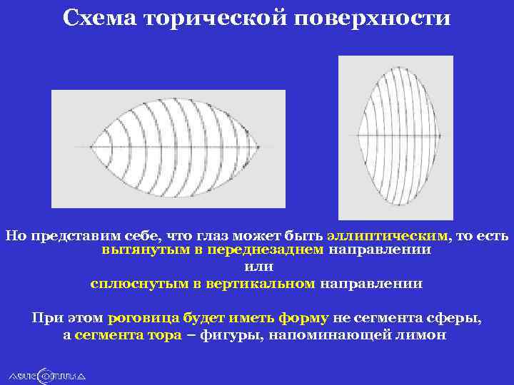 Схема торической поверхности Но представим себе, что глаз может быть эллиптическим, то есть вытянутым