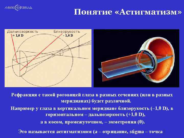 Понятие «Астигматизм» + 1, 0 D - 1, 0 D Рефракция с такой роговицей