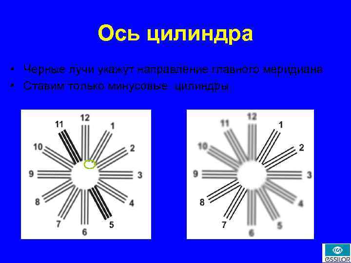 Тест на астигматизм по картинкам