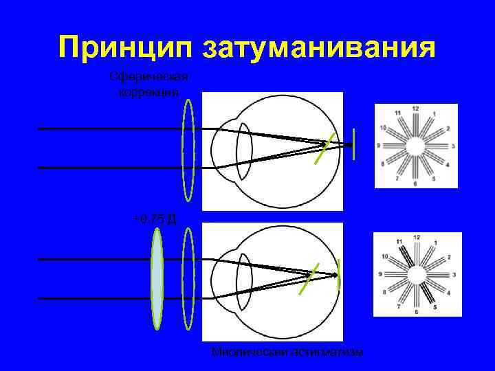 Астигматизм картинки для проверки