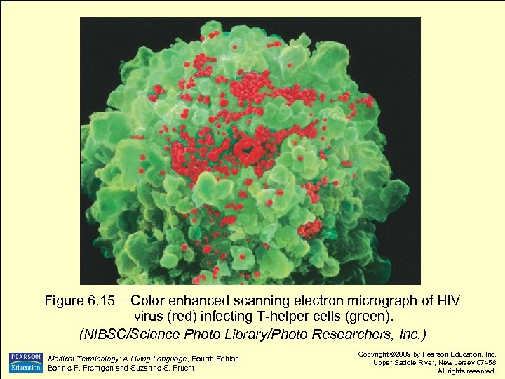 Figure 6. 15 – Color enhanced scanning electron micrograph of HIV virus (red) infecting