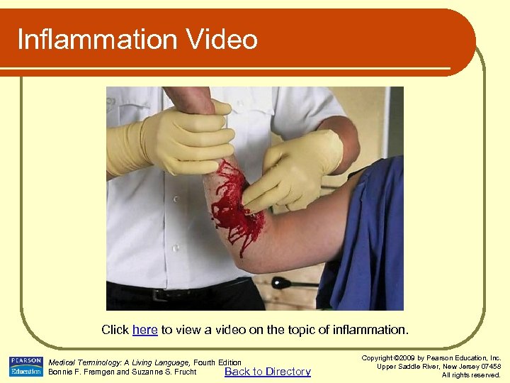 Inflammation Video Click here to view a video on the topic of inflammation. Medical