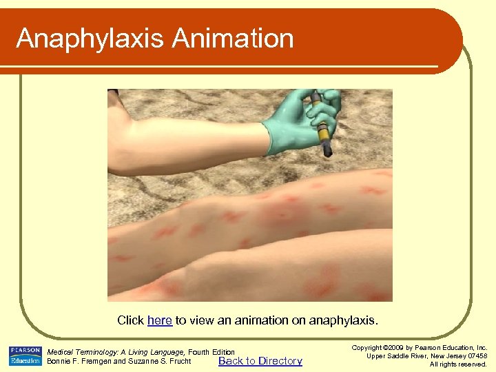 Anaphylaxis Animation Click here to view an animation on anaphylaxis. Medical Terminology: A Living