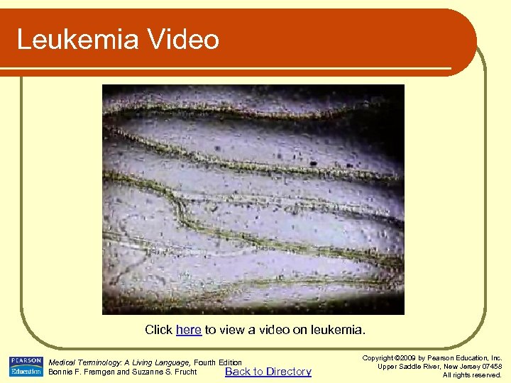 Leukemia Video Click here to view a video on leukemia. Medical Terminology: A Living