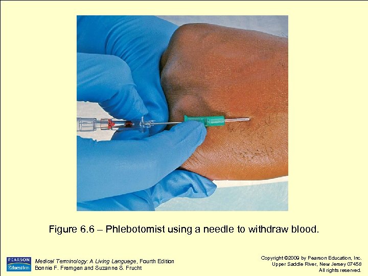 Figure 6. 6 – Phlebotomist using a needle to withdraw blood. Language, Fourth Edition