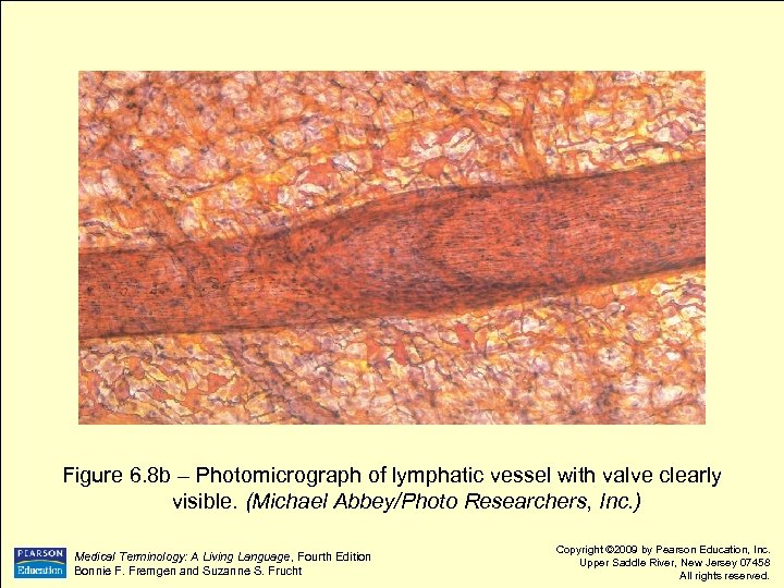 Figure 6. 8 b – Photomicrograph of lymphatic vessel with valve clearly visible. (Michael