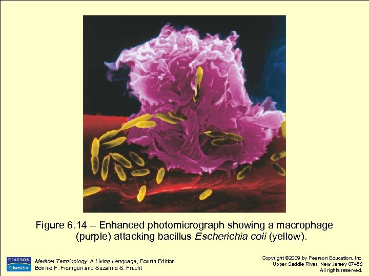 Figure 6. 14 – Enhanced photomicrograph showing a macrophage (purple) attacking bacillus Escherichia coli