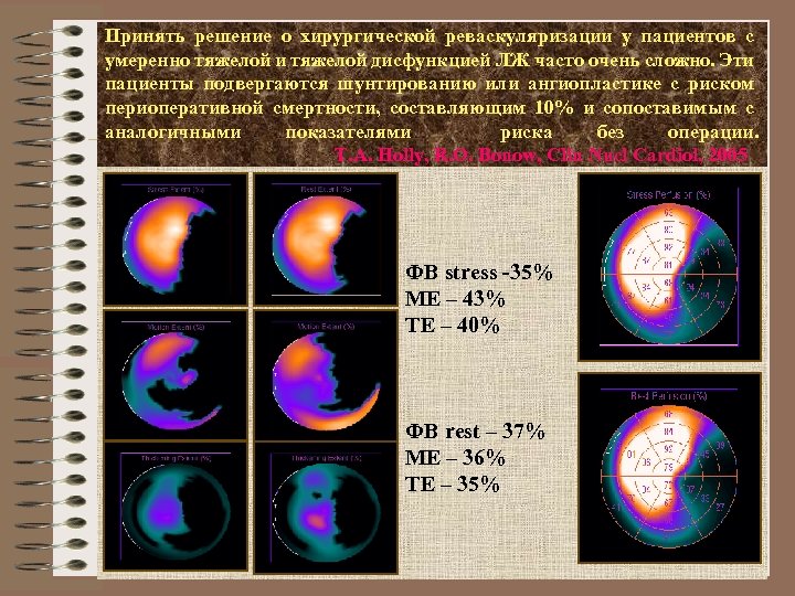 Принять решение о хирургической реваскуляризации у пациентов с умеренно тяжелой и тяжелой дисфункцией ЛЖ