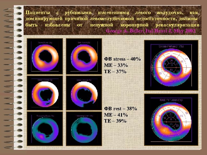 Пациенты с рубцовыми изменениями левого желудочка, как доминирующей причиной левожелудочковой недостаточности, должны быть избавлены