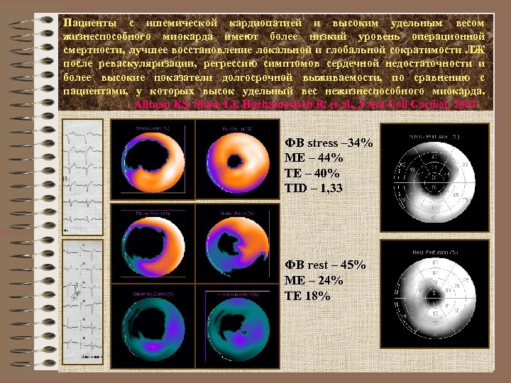 Пациенты с ишемической кардиопатией и высоким удельным весом жизнеспособного миокарда имеют более низкий уровень