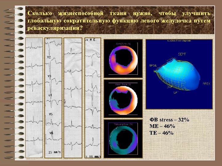 Сколько жизнеспособной ткани нужно, чтобы улучшить глобальную сократительную функцию левого желудочка путем реваскуляризации? ФВ