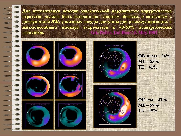 Для оптимизация исходов ишемической кардиопатии хирургическая стратегия должна быть направлена, главным образом, к пациентам