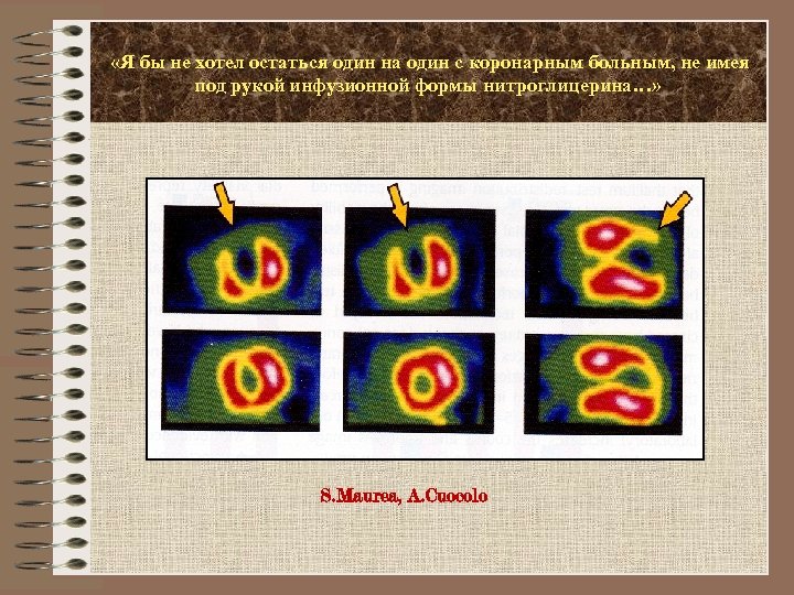  «Я бы не хотел остаться один на один с коронарным больным, не имея