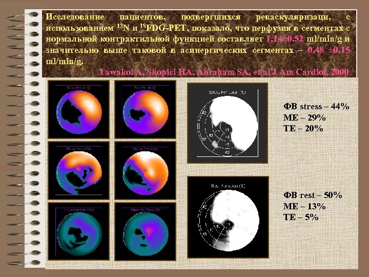 Исследование пациентов, подвергшихся реваскуляризаци, c использованием 13 N и 18 FDG-PET, показало, что перфузия