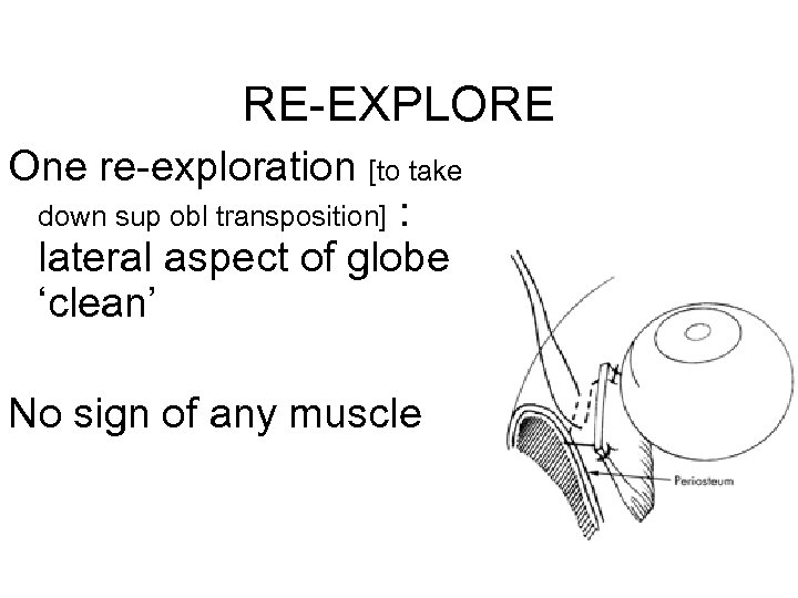 RE-EXPLORE One re-exploration [to take down sup obl transposition] : lateral aspect of globe