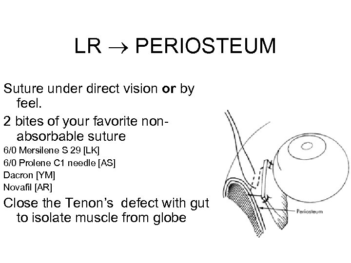 LR PERIOSTEUM Suture under direct vision or by feel. 2 bites of your favorite