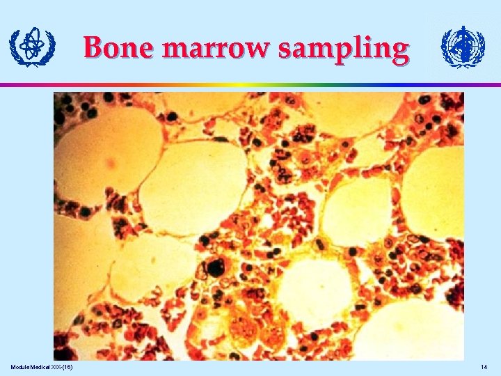 Bone marrow sampling Module Medical XIX-(16) 14 