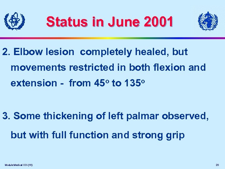 Status in June 2001 2. Elbow lesion completely healed, but movements restricted in both