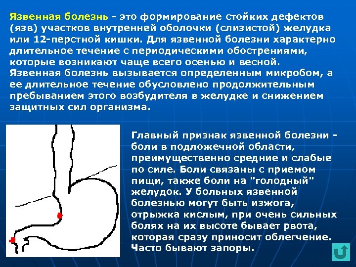 Язвенная болезнь - это формирование стойких дефектов (язв) участков внутренней оболочки (слизистой) желудка или