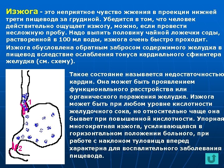 Изжога - это неприятное чувство жжения в проекции нижней трети пищевода за грудиной. Убедится