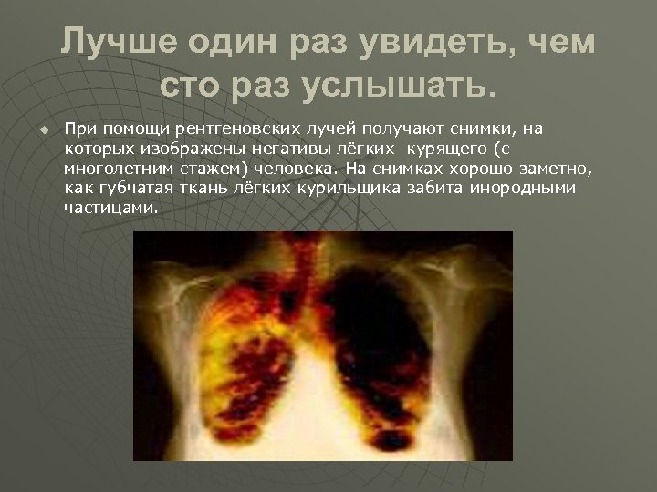 Лучше один раз увидеть, чем сто раз услышать. u При помощи рентгеновских лучей получают