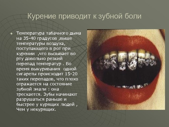 Курение приводит к зубной боли u Температура табачного дыма на 35 -40 градусов ,