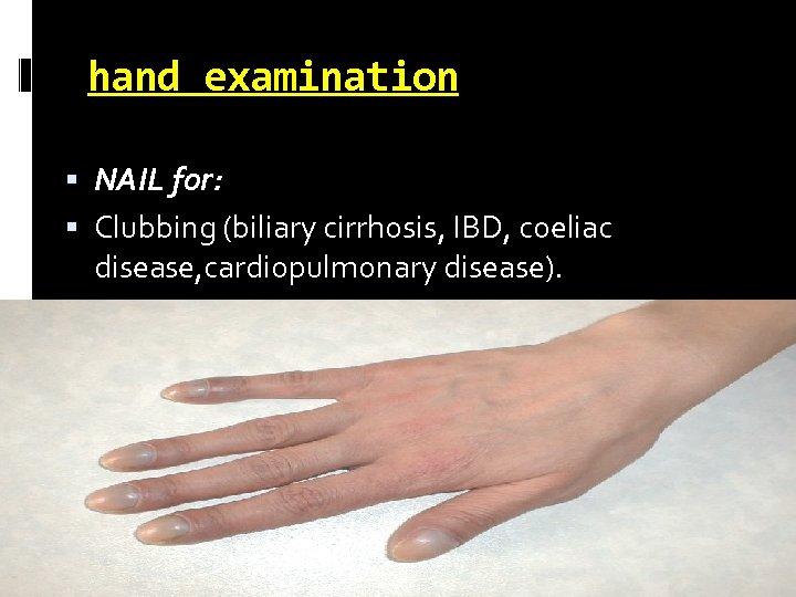 hand examination NAIL for: Clubbing (biliary cirrhosis, IBD, coeliac disease, cardiopulmonary disease). 