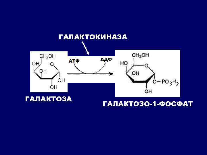 ГАЛАКТОКИНАЗА ГАЛАКТОЗО-1 -ФОСФАТ 