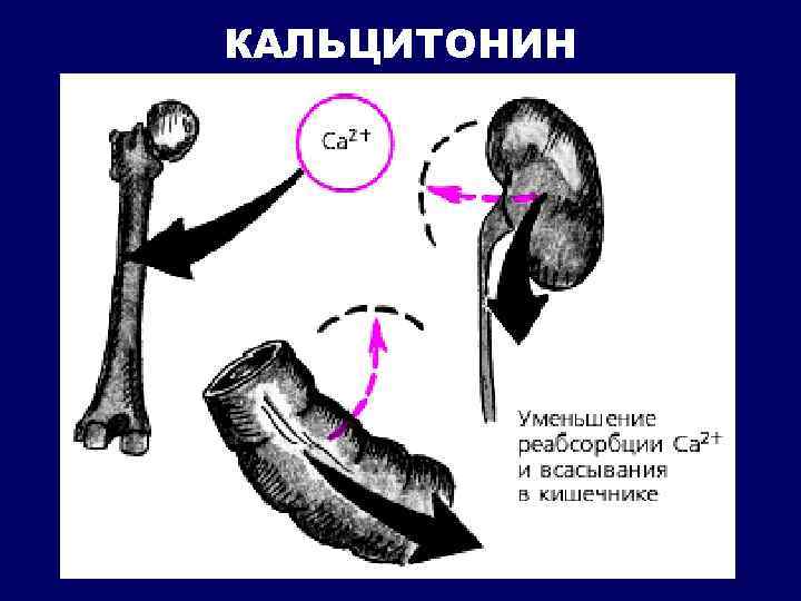 КАЛЬЦИТОНИН 