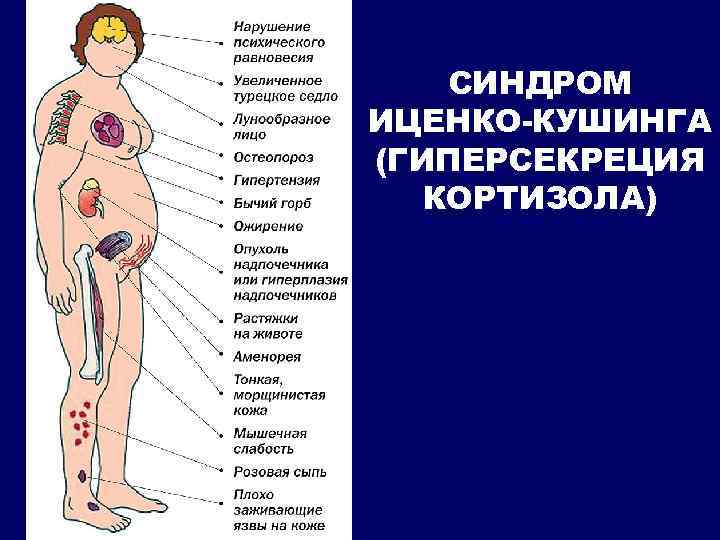 СИНДРОМ ИЦЕНКО-КУШИНГА (ГИПЕРСЕКРЕЦИЯ КОРТИЗОЛА) 