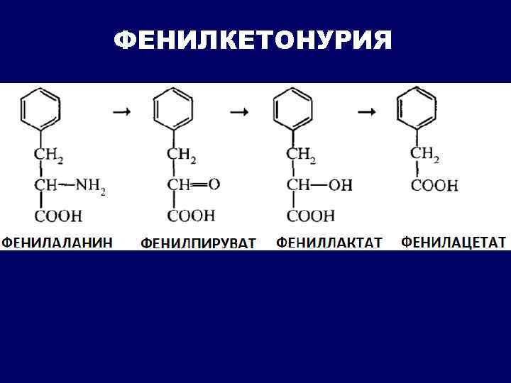 ФЕНИЛКЕТОНУРИЯ 