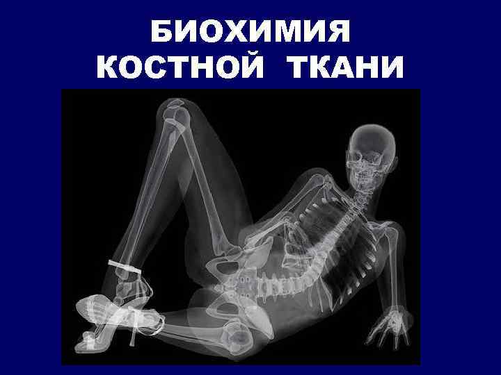 БИОХИМИЯ КОСТНОЙ ТКАНИ 