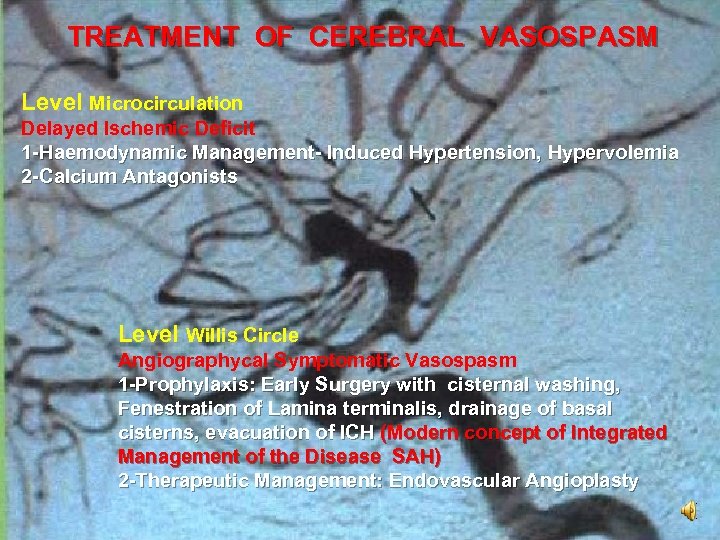 TREATMENT OF CEREBRAL VASOSPASM Level Microcirculation Delayed Ischemic Deficit 1 -Haemodynamic Management- Induced Hypertension,